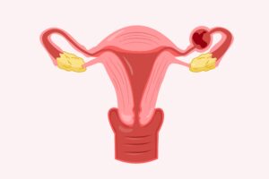 What-is-an-ectopic-pregnancy-alcove-health-newportnews