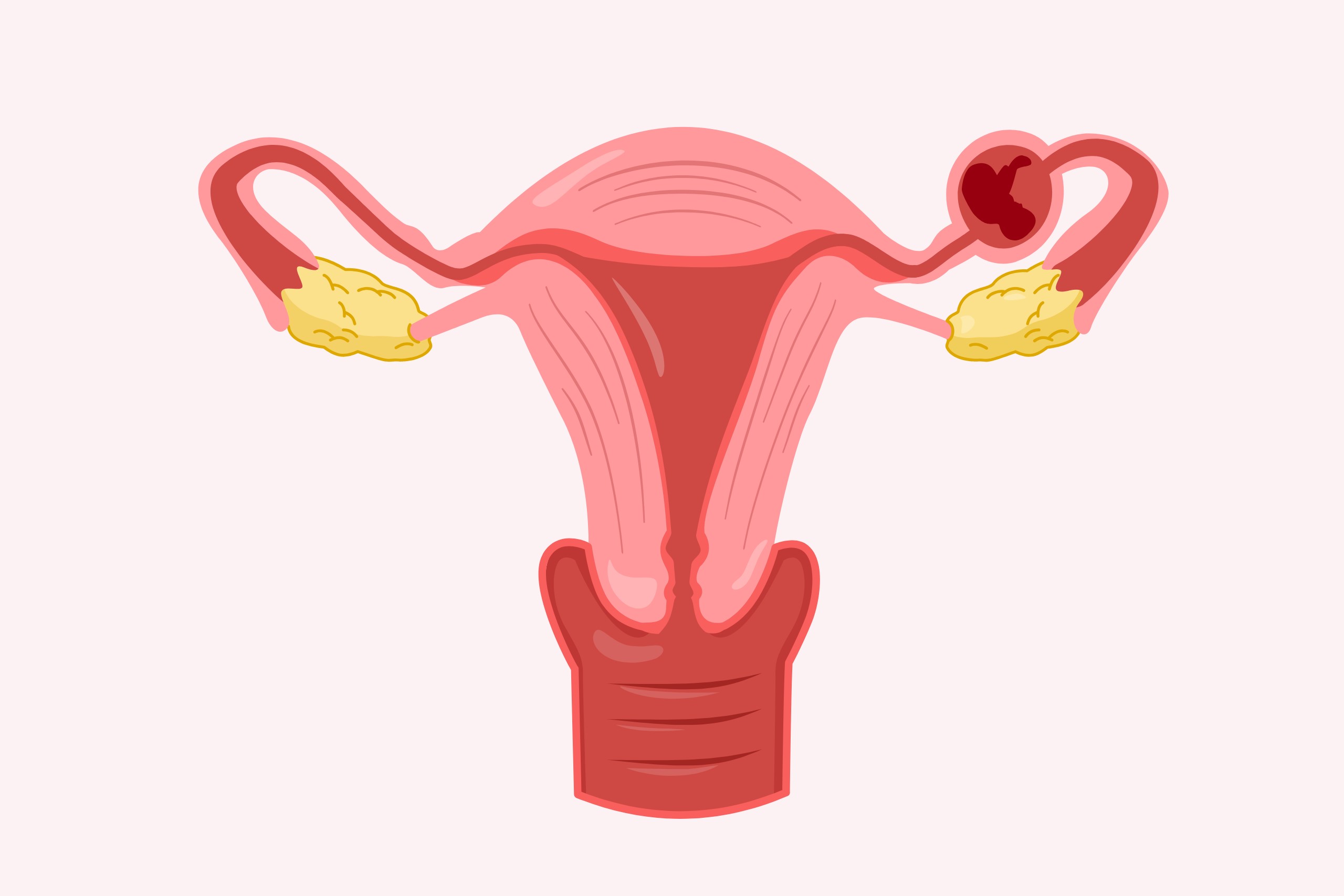 What-is-an-ectopic-pregnancy-alcove-health-newportnews