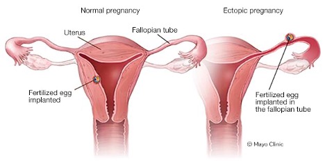 What is a limited ultrasound and why do I need one? - Alcove Health Women's Clinic Newport News, VA