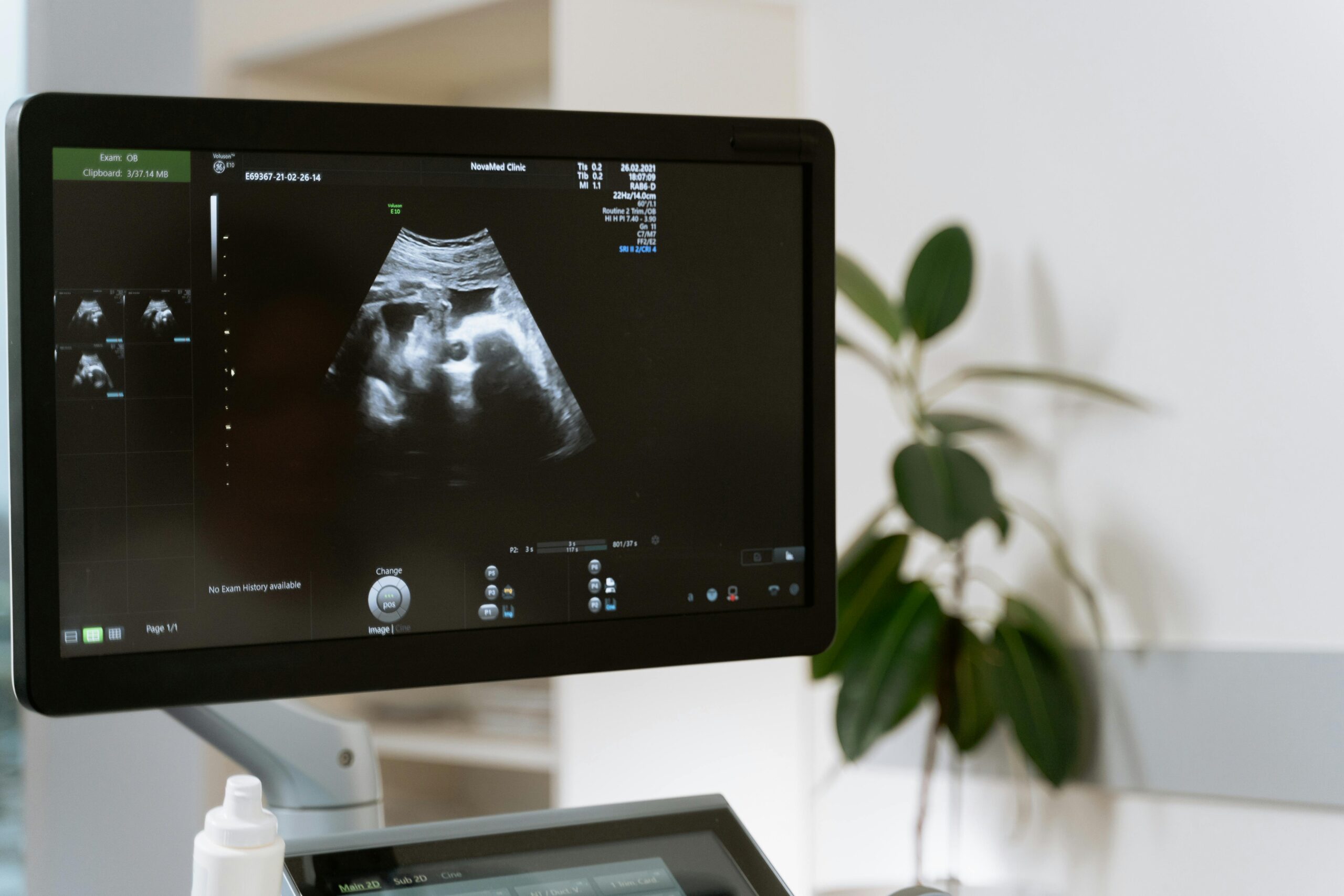 Tell Me, What is the Difference Between an Ultrasound and a Sonogram? - Alcove Health Women's Clinic Newport News, VA