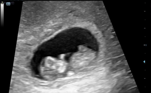 Tell Me, What is the Difference Between an Ultrasound and a Sonogram? - Alcove Health Women's Clinic Newport News, VA
