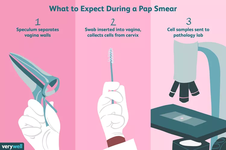 The 4 W's of the Pap Exam - Alcove Health Women's Clinic Newport News, VA