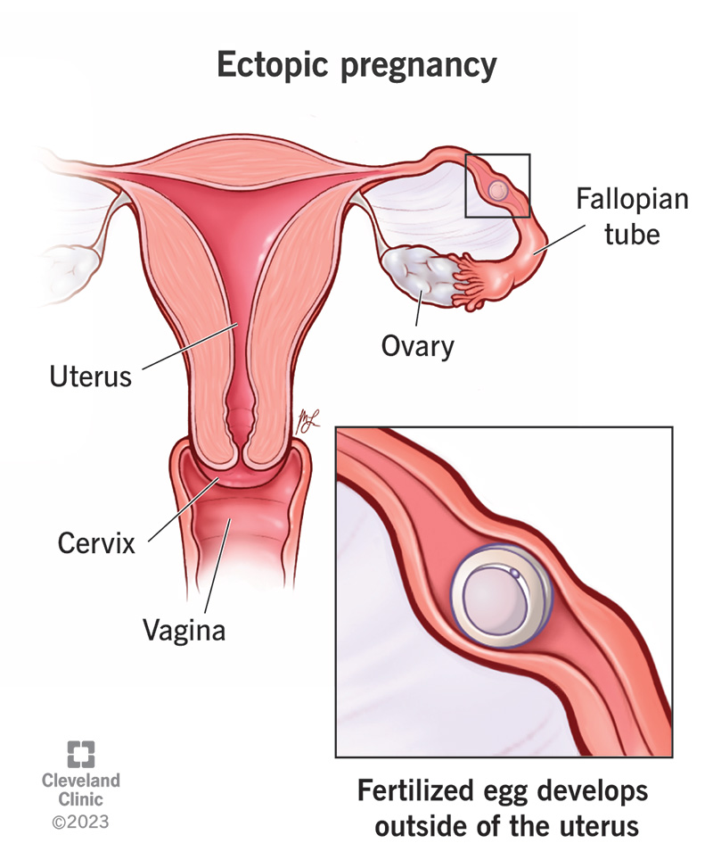 For Teens: 5 Things To Know About Pregnancy - Alcove Health Women's Clinic Newport News, VA